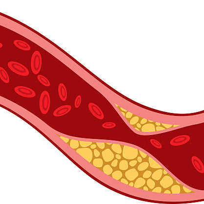 What is cholesterol?