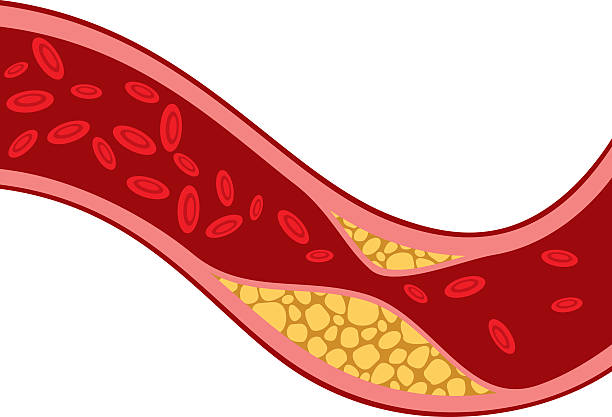 What is cholesterol?