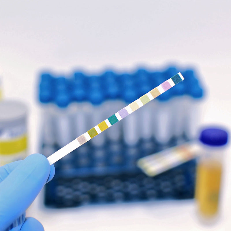 DNX Test-It Urinalysis 10 Parameter 100 Test Strips